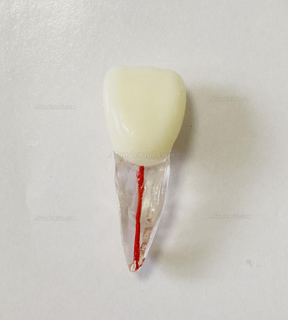 Dental Teeth Model Endo Files Practise Molar Upper Lower Tooth Premolar Root 2/3-Rooted Canal